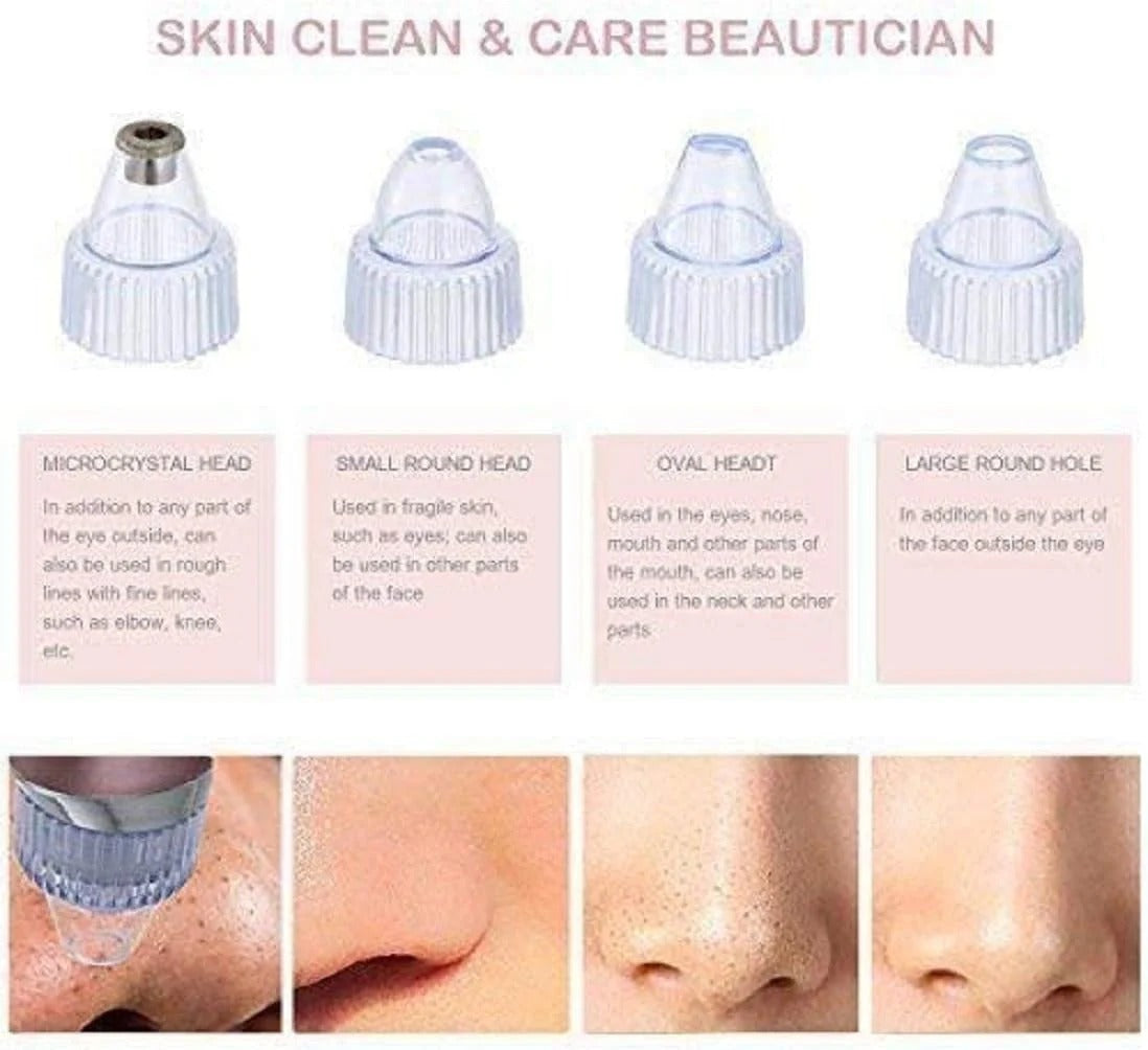 Blackhead Remover Tool 💆‍♀